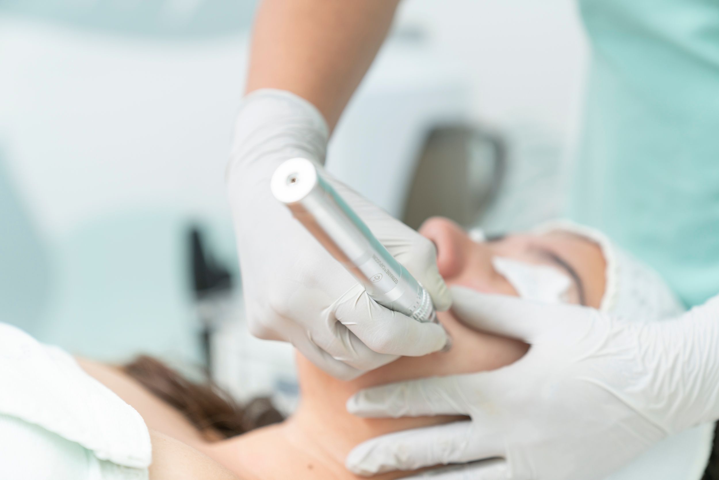 Collagen Induction Facial